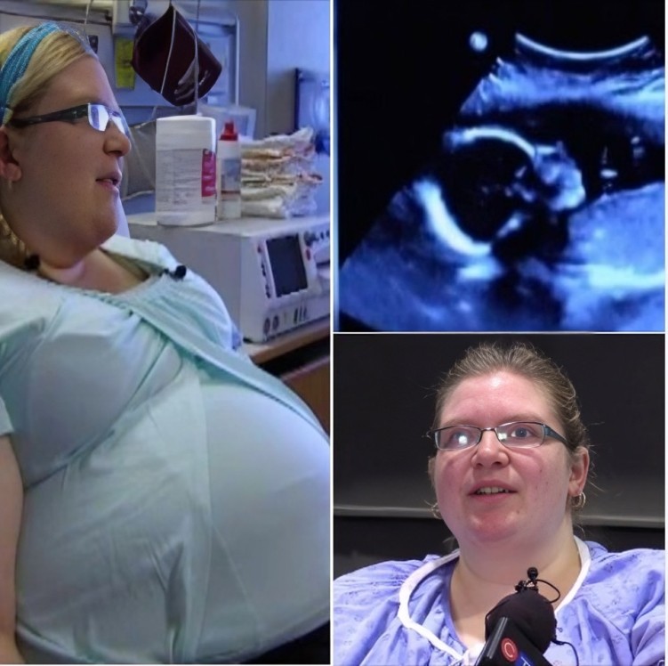 Couple shocked when they see ultrasound – then nurse states that it’s 1 in 15 million