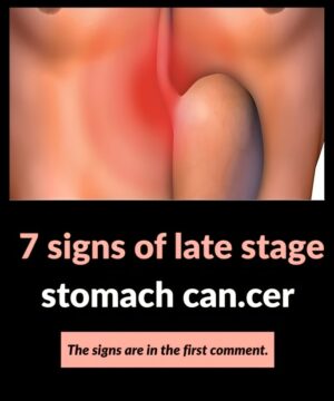 7 Signs of Advanced Stomach Cancer