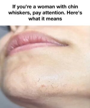 That Pesky Chin Hair? Here’s What Your Body Might Be Telling You