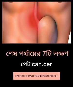 উন্নত পেট ক্যান্সারের ৭টি লক্ষণ