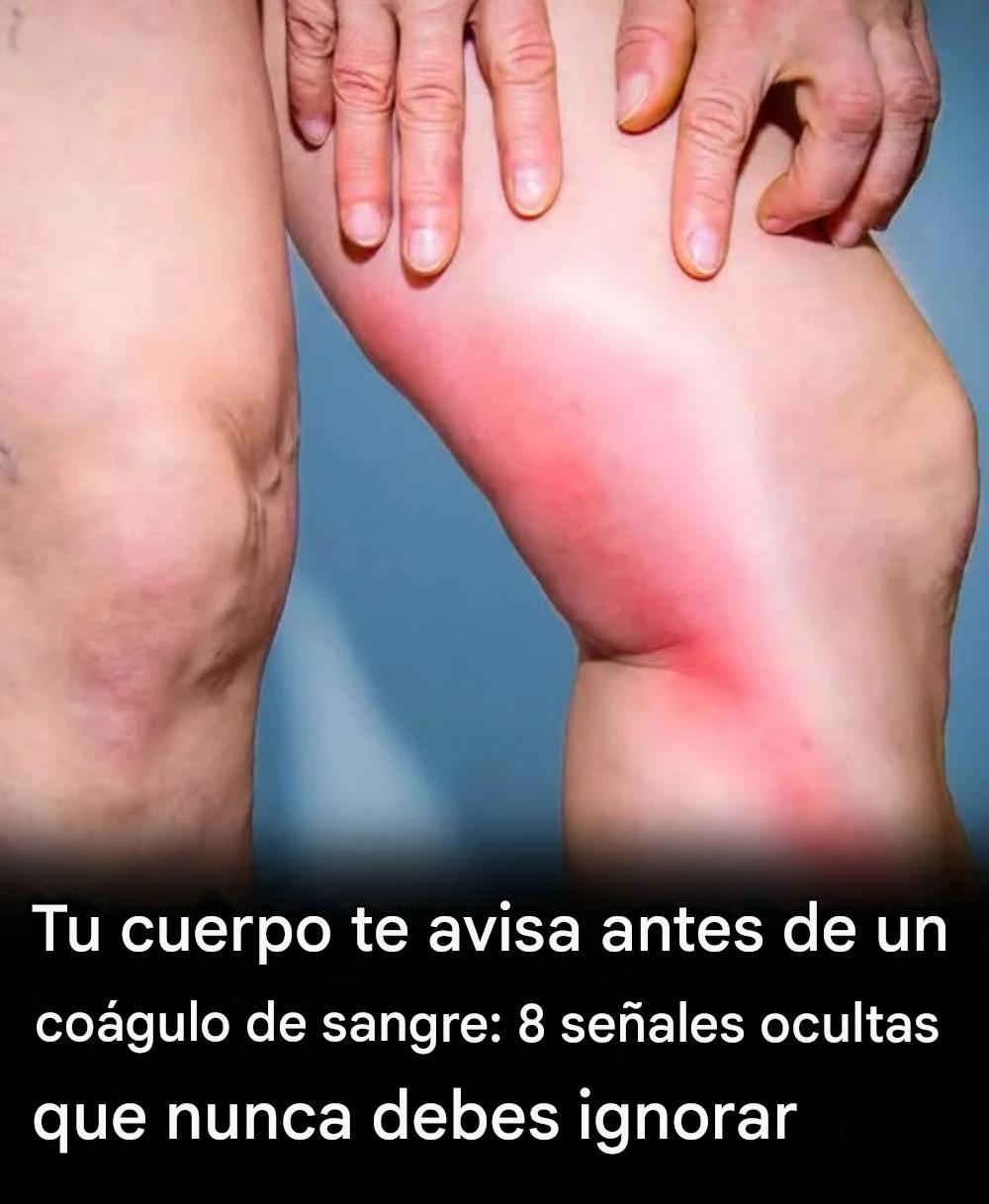 Tu cuerpo te avisa antes de un coágulo de sangre: 8 señales ocultas que nunca debes ignorar