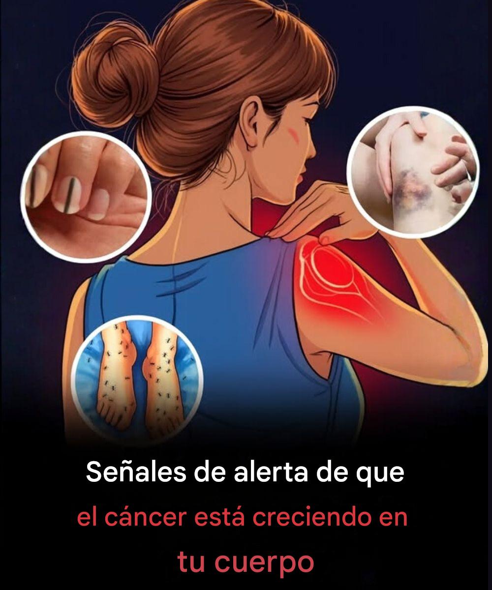 22 señales preocupantes de que tu cuerpo intenta advertirte sobre problemas de salud graves (y qué hacer al respecto) #ACTOS DE BONDAD